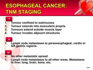 ESOPHAGEAL CANCER:              TNM STAGINGTTumour confined to submucosaTumour extends into muscularispropriaTumours extend outside muscle layerTumour invades adjacent structuresLymph node metastases to paraoesophageal, cardia or left gastric regions.No other metastatic spreadLymph node metastases to all other areas. Metastases to liver, lung, brain, bone, etc.NM25/81
