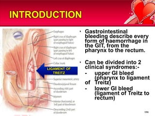 INTRODUCTIONGastrointestinal bleeding describe every form of haemorrhage in the GIT, from the pharynx to the rectum.Can be divided into 2 clinical syndromes:-	-  	upper GI bleed 	(pharynx to ligament of 	Treitz)	-  	lower GI bleed 	(ligament of Treitz to 	rectum)LIGAMENT OF TREITZ7/81