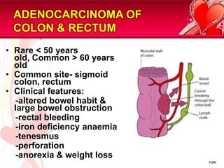 INVESTIGATIONS	-	full blood count – Hb, WCC	-	liver function test – cirrhosis	-	coagulation profile	-	renal profile	-	RBC morphology	-	OGDS	-	Barium meal / Double-contrast barium meal	-	Ultrasound	-	CT scanBASELINE INVESTIGATIONIMAGING45/81