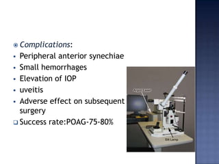 Application of laser beam:at the junction of pigmented and non pigmented trabeculum.Ideal reaction:minute gas bubble or blanching