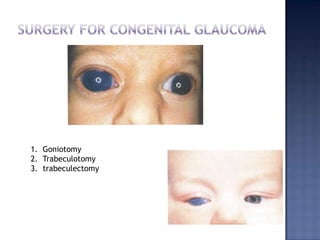 Adverse effect on subsequent filtering surgery