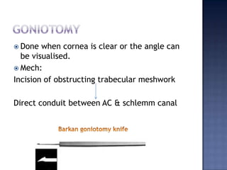 Success rate:POAG-75-80%selective LASER TRABECULOPLASTYNd:yag laser Laser targets only the pigmented cells in TMAdvantage over ALT-the surgeon can repeat the surgery over the same angle
