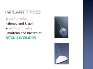 Partial thickness scleral flap