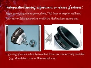 Postoperative lasering, adjustment, or release of sutures : 
Argon green, argon blue-green, diode, YAG laser or krypton red laser. 
Four-mirror Zeiss gonioprism or with the Hoskins laser suture lens . 
High-magnification suture lysis contact lenses are commercially available 
(e.g., Mandlekorn lens or Blumenthal lens ) 
 