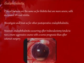 Endophthalmitis: 
Clinical features c 
are the same as for blebitis but are more severe, with 
decreased VA and vitritis. 
Investigate and treat as for other postoperative endophthalmitis. 
However, endophthalmitis occurring after trabeculectomy tends to 
run a more aggressive course with a worse prognosis than after 
cataract surgery. 
 