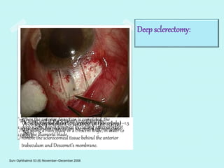 Deep sclerectomy: 
The superficial scleral flap is one-third of the 
scleral thickness and is dissected 1--1.5 mm 
into clear cornea. 
The sclera is exposed and a superficial scleral 
flap measuring 5 5 mm is dissected, including 
one-third of the scleral thickness 
The When deep the sclerectomy anterior dissection measures is 4 completed, 4 mm and the 
sclera is 
dissected, deep scleral leaving flap about is removed 5% of by sclera cutting over anteriorly the choroid 
first 
and with ciliary the diamond body. 
blade. 
The inner wall of the Sclemm’s canal and the 
juxtacanalicular trabeculum are peeled off using fine 
forceps. 
TThhee A collagen s Sclcehrolceomrnmea’lsdciassnecatli implant is oins sutured iisd pernotloifniegded. in the anteriorly scleral 
1--1.5 
mm bed. 
using a ruby blade or a crescent knife, in order to 
remove the sclerocorneal tissue behind the anterior 
trabeculum and Descemet’s membrane. 
Surv Ophthalmol 53 (6) November--December 2008 
 