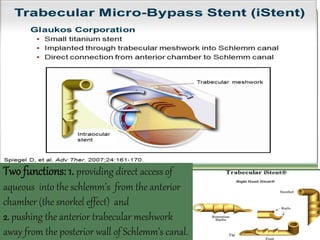 Two functions: 1. providing direct access of 
aqueous into the schlemm’s from the anterior 
chamber (the snorkel effect) and 
2. pushing the anterior trabecular meshwork 
away from the posterior wall of Schlemm’s canal. 
 
