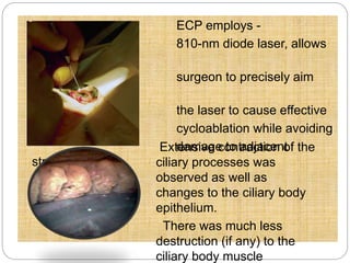 ECP employs - 
810-nm diode laser, allows 
the 
surgeon to precisely aim 
and deploy 
the laser to cause effective 
cycloablation while avoiding 
damage to adjacent 
structures. 
Extensive contraction of the 
ciliary processes was 
observed as well as 
changes to the ciliary body 
epithelium. 
There was much less 
destruction (if any) to the 
ciliary body muscle 
 