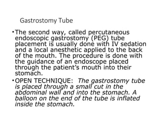 Gastrostomy Tube
•The second way, called percutaneous
endoscopic gastrostomy (PEG) tube
placement is usually done with IV sedation
and a local anesthetic applied to the back
of the mouth. The procedure is done with
the guidance of an endoscope placed
through the patient’s mouth into their
stomach.
•OPEN TECHNIQUE: The gastrostomy tube
is placed through a small cut in the
abdominal wall and into the stomach. A
balloon on the end of the tube is inflated
inside the stomach.
 