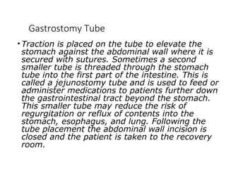 Gastrostomy Tube
• Traction is placed on the tube to elevate the
stomach against the abdominal wall where it is
secured with sutures. Sometimes a second
smaller tube is threaded through the stomach
tube into the first part of the intestine. This is
called a jejunostomy tube and is used to feed or
administer medications to patients further down
the gastrointestinal tract beyond the stomach.
This smaller tube may reduce the risk of
regurgitation or reflux of contents into the
stomach, esophagus, and lung. Following the
tube placement the abdominal wall incision is
closed and the patient is taken to the recovery
room.
 