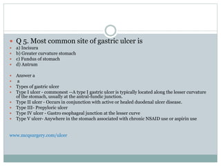  Q 5. Most common site of gastric ulcer is
 a) Incisura
 b) Greater curvature stomach
 c) Fundus of stomach
 d) Antrum
 Answer a
 a
 Types of gastric ulcer
 Type I ulcer - commonest --A type I gastric ulcer is typically located along the lesser curvature
of the stomach, usually at the antral-fundic junction.
 Type II ulcer - Occurs in conjunction with active or healed duodenal ulcer disease.
 Type III- Prepyloric ulcer
 Type IV ulcer - Gastro esophageal junction at the lesser curve
 Type V ulcer- Anywhere in the stomach associated with chronic NSAID use or aspirin use
www.mcqsurgery.com/ulcer
 