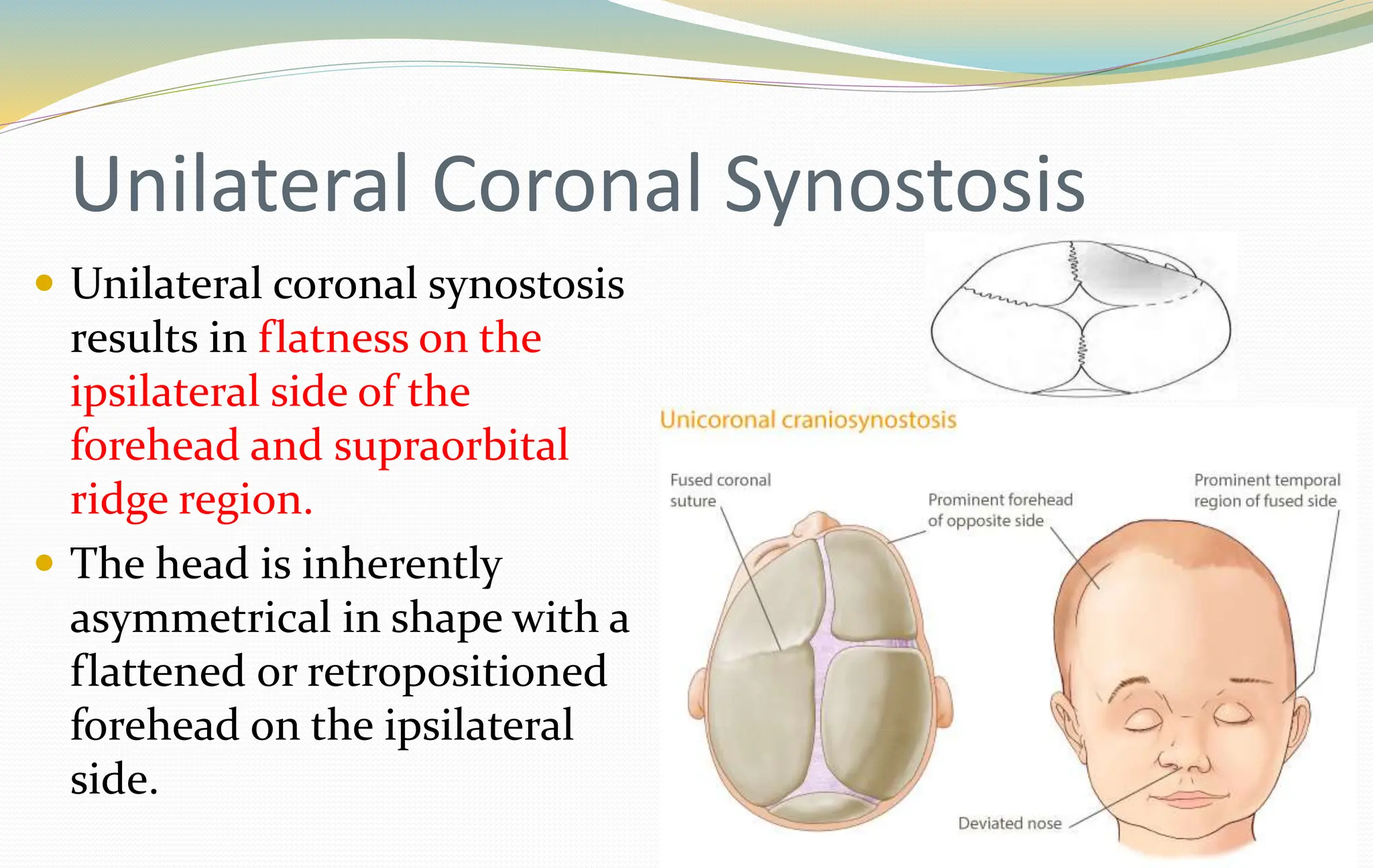 SURGERY OF CRANIOFACIAL ANOMALIES.pptx