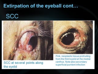 SCC
Extirpation of the eyeball cont…
 