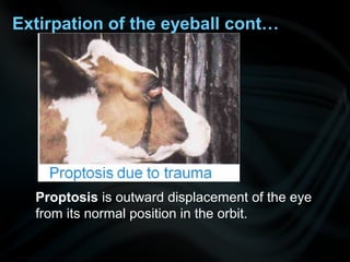 Extirpation of the eyeball cont…
Proptosis is outward displacement of the eye
from its normal position in the orbit.
 