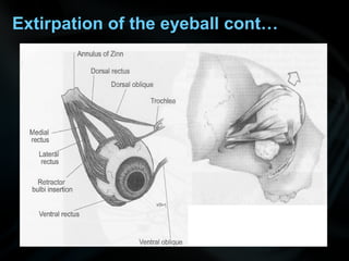 Extirpation of the eyeball cont…
 