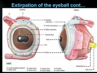 Extirpation of the eyeball cont…
 