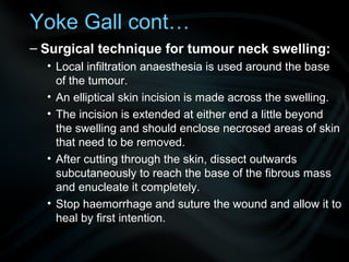 – Surgical technique for tumour neck swelling:
• Local infiltration anaesthesia is used around the base
of the tumour.
• An elliptical skin incision is made across the swelling.
• The incision is extended at either end a little beyond
the swelling and should enclose necrosed areas of skin
that need to be removed.
• After cutting through the skin, dissect outwards
subcutaneously to reach the base of the fibrous mass
and enucleate it completely.
• Stop haemorrhage and suture the wound and allow it to
heal by first intention.
Yoke Gall cont…
 