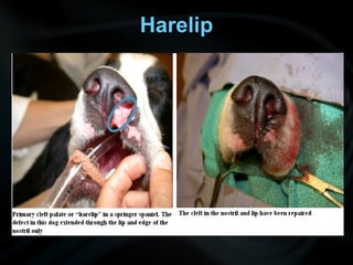 Harelip
 