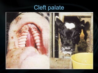 Cleft palate
 
