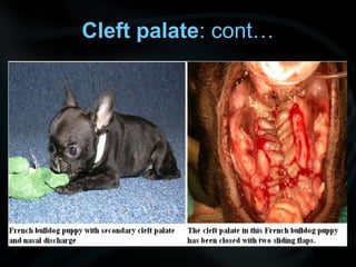 Cleft palate: cont…
 