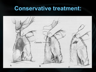 Conservative treatment:
 