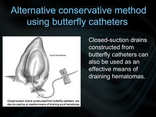 Alternative conservative method
using butterfly catheters
Closed-suction drains
constructed from
butterﬂy catheters can
also be used as an
effective means of
draining hematomas.
 