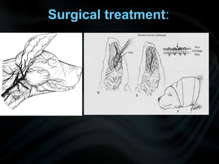 Surgical treatment:
 