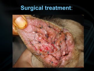 Surgical treatment:
 