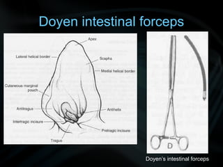 Doyen intestinal forceps
Doyen’s intestinal forceps
 