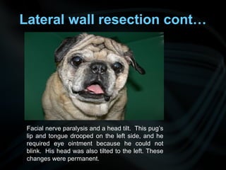 Lateral wall resection cont…
Facial nerve paralysis and a head tilt. This pug’s
lip and tongue drooped on the left side, and he
required eye ointment because he could not
blink. His head was also tilted to the left. These
changes were permanent.
 