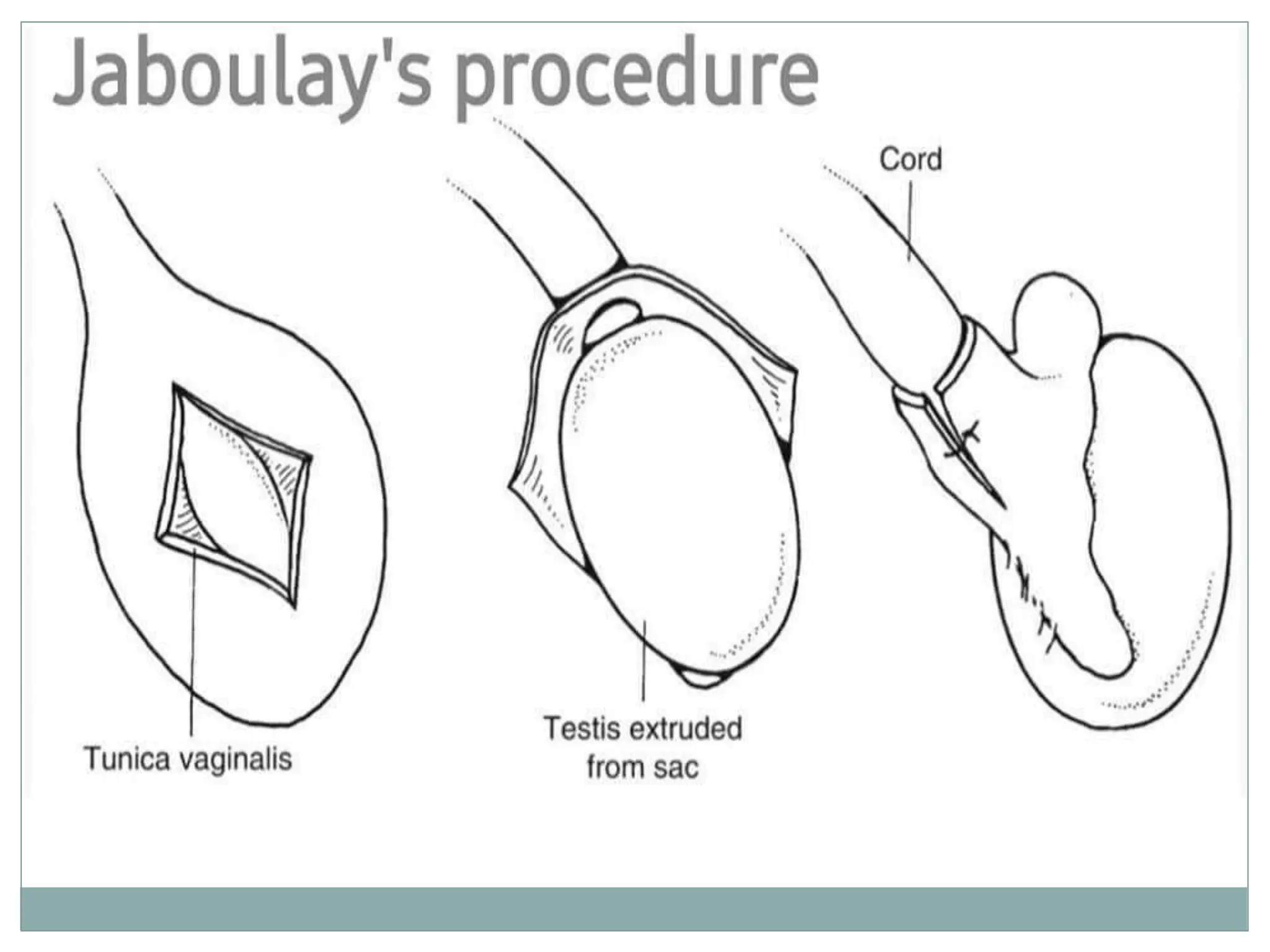 The Shocking Truth About Your Surgery: Operative Review Revealed - v1dp1ct