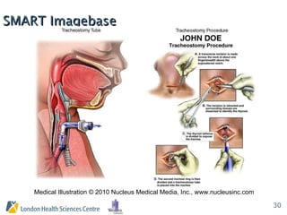 Medical Illustration © 2010 Nucleus Medical Media, Inc., www.nucleusinc.com SMART Imagebase 