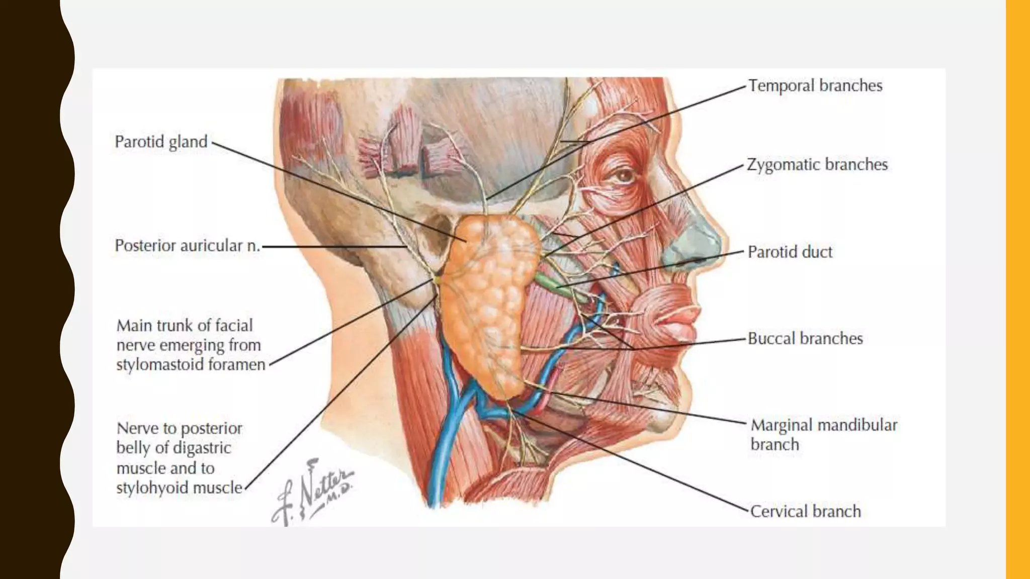 Parotid Incision Types Parotid gland swelling | PPTX