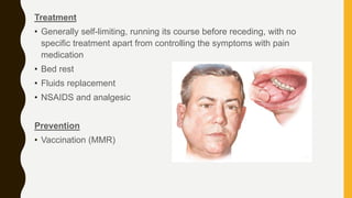 Parotid gland swelling | PPTX