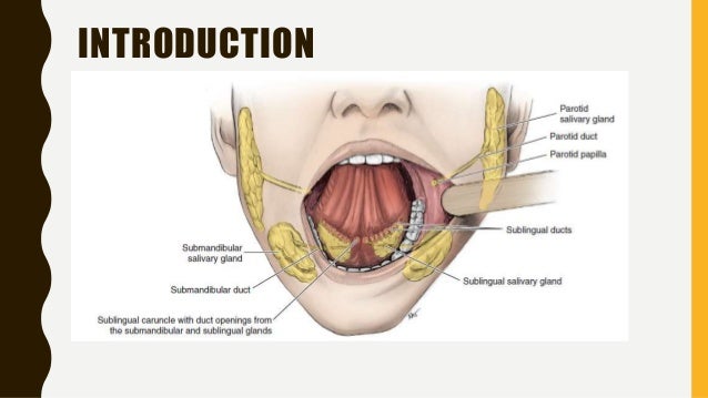 Parotid Gland Swelling