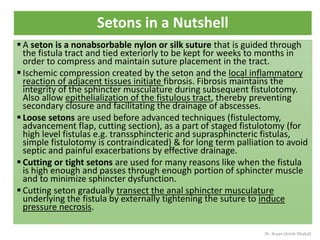Surgery Review Booklet by Dr. Aryan (Medical Booklet Series by Dr ...