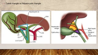 General surgery specimens | PPTX