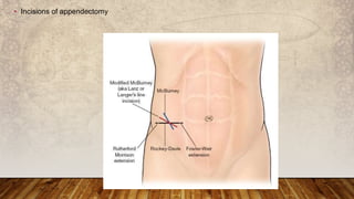General surgery specimens | PPTX