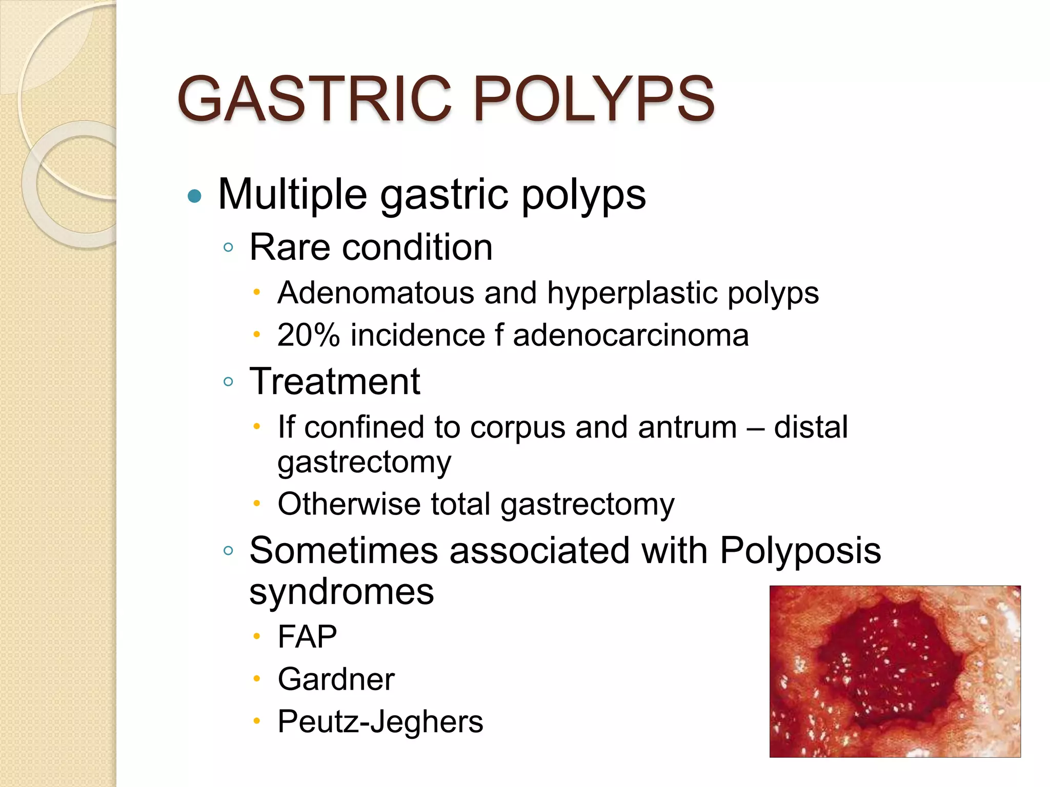 Surgerystomachduodenumtg hegazy | PPT