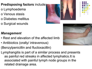 Erysipelas
Erysipelas is a sharply
demarcated streptococcal
infection of skin, usually
associated with broken skin on
the ...