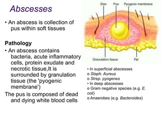 Clinical features
1- Superficial
abscesses include
infected sebaceous
cysts, breast and
pilonidal abscesses.
superficial a...