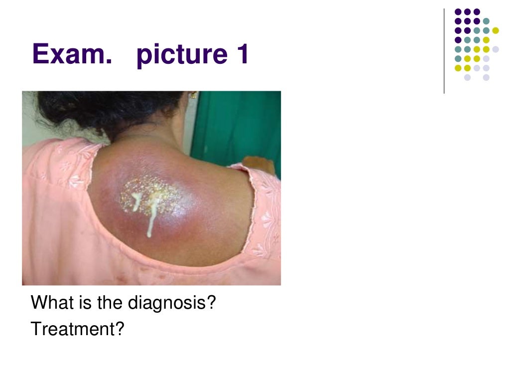 Surgery(surgical infections) 12