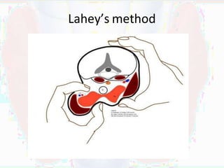 Lahey Incision Surgery Thyroid.pptx