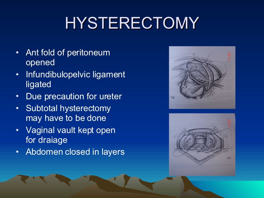 SURGICAL MANAGEMENT OF SEPTIC ABORTION