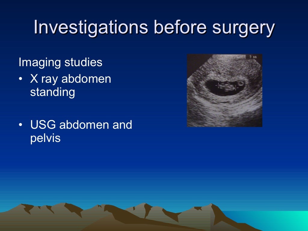 SURGICAL MANAGEMENT OF SEPTIC ABORTION