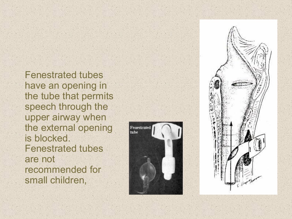 Surgical airway procedures