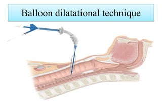 Surgical airway techniques | PPTX