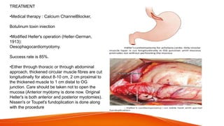 TREATMENT
•Medical therapy : Calcium ChannelBlocker,
Botulinum toxin iniection
•Modified Heller's operation (Heller-German,
1913):
Oesophagocardiomyotomy.
Success rate is 85%.
•Either through thoracic or through abdominal
approach, thickened circular muscle fibres are cut
longitudinally for about 8-10 cm, 2 cm proximal to
the thickened muscle to 1 cm distal to OG
junction. Care should be taken not to open the
mucosa (Anterior myotomy is done now. Original
Heller's is both anterior and posterior myotomies).
Nissen's or Toupet's fundoplication is done along
with the procedure
 
