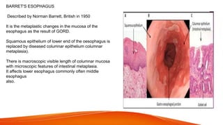 BARRET'S ESOPHAGUS
Described by Norman Barrett, British in 1950
It is the metaplastic changes in the mucosa of the
esophagus as the result of GORD.
Squamous epithelium of lower end of the oesophagus is
replaced by diseased columnar epithelium columnar
metaplasia).
There is macroscopic visible length of columnar mucosa
with microscopic features of intestinal metaplasia.
It affects lower esophagus commonly often middle
esophagus
also.
 