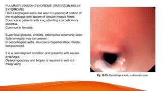 PLUMMER-VINSON SYNDROME (PATERSON-KELLY
SYNDROME)
Here esophageal webs are seen in uppermost portion of
the esophagus with spasm of circular muscle fibres.
Common in patients with long standing iron deficiency
anaemia.
Common in females.
Superficial glossitis, cheilitis, koilonychia commonly seen.
Splenomegaly may be present.
In oesophageal webs, mucosa is hyperkeratotic, friable,
desquamated.
It is a premalignant condition and presents with severe
dysphagia.
Oesophagoscopy and biopsy is required to rule out
malignancy.
 